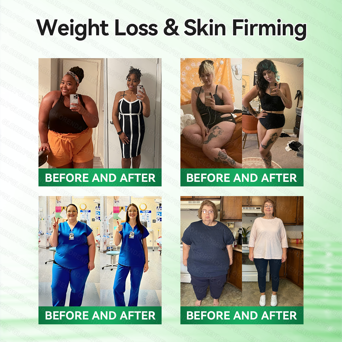 𝑶𝒇𝒇𝒊𝒄𝒊𝒂𝒍 𝑺𝒕𝒐𝒓𝒆  |🍀🍀𝐂𝐚𝐫𝐞𝐔𝐩𝐥𝐢𝐟𝐭® 𝑴𝒆𝒕𝒂𝒃𝒐𝒍𝒊𝒄 𝑵𝒂𝒏𝒐 𝑴𝒊𝒄𝒓𝒐𝒏𝒆𝒆𝒅𝒍𝒆 𝑷𝒂𝒕𝒄𝒉🇺🇸(𝐉𝐮𝐬𝐭 𝐨𝐧𝐜𝐞 𝐚 𝐝𝐚𝐲）𝘽𝙚𝙧𝙗𝙚𝙧𝙞𝙣𝙚 + 𝙈𝙤𝙧𝙞𝙣𝙜𝙖 𝙁𝙤𝙧𝙢𝙪𝙡𝙖 ✅ 𝐅𝐨𝐫 𝐨𝐛𝐞𝐬𝐢𝐭𝐲, 𝗟𝗼𝗼𝘀𝗲 𝘀𝗸𝗶𝗻,𝐝𝐢𝐚𝐛𝐞𝐭𝐞𝐬, 𝐬𝐥𝐞𝐞𝐩 𝐚𝐩𝐧𝐞𝐚, 𝐣𝐨𝐢𝐧𝐭 𝐢𝐬𝐬𝐮𝐞𝐬, 𝐚𝐧𝐝 𝐦𝐨𝐫𝐞💯💯