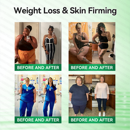 𝑶𝒇𝒇𝒊𝒄𝒊𝒂𝒍 𝑺𝒕𝒐𝒓𝒆  |🍀🍀𝐂𝐚𝐫𝐞𝐔𝐩𝐥𝐢𝐟𝐭® 𝑴𝒆𝒕𝒂𝒃𝒐𝒍𝒊𝒄 𝑵𝒂𝒏𝒐 𝑴𝒊𝒄𝒓𝒐𝒏𝒆𝒆𝒅𝒍𝒆 𝑷𝒂𝒕𝒄𝒉🇺🇸(𝐉𝐮𝐬𝐭 𝐨𝐧𝐜𝐞 𝐚 𝐝𝐚𝐲）𝘽𝙚𝙧𝙗𝙚𝙧𝙞𝙣𝙚 + 𝙈𝙤𝙧𝙞𝙣𝙜𝙖 𝙁𝙤𝙧𝙢𝙪𝙡𝙖 ✅ 𝐅𝐨𝐫 𝐨𝐛𝐞𝐬𝐢𝐭𝐲, 𝗟𝗼𝗼𝘀𝗲 𝘀𝗸𝗶𝗻,𝐝𝐢𝐚𝐛𝐞𝐭𝐞𝐬, 𝐬𝐥𝐞𝐞𝐩 𝐚𝐩𝐧𝐞𝐚, 𝐣𝐨𝐢𝐧𝐭 𝐢𝐬𝐬𝐮𝐞𝐬, 𝐚𝐧𝐝 𝐦𝐨𝐫𝐞💯💯