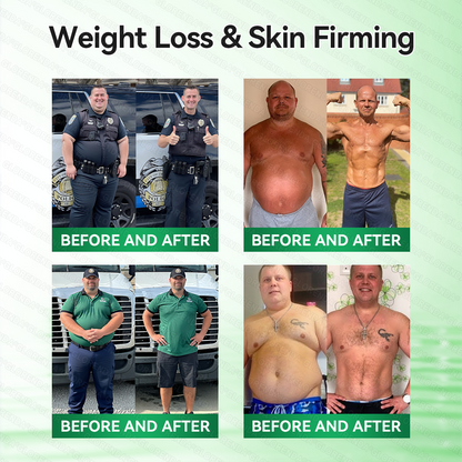 𝑶𝒇𝒇𝒊𝒄𝒊𝒂𝒍 𝑺𝒕𝒐𝒓𝒆  |🍀🍀𝐂𝐚𝐫𝐞𝐔𝐩𝐥𝐢𝐟𝐭® 𝑴𝒆𝒕𝒂𝒃𝒐𝒍𝒊𝒄 𝑵𝒂𝒏𝒐 𝑴𝒊𝒄𝒓𝒐𝒏𝒆𝒆𝒅𝒍𝒆 𝑷𝒂𝒕𝒄𝒉🇺🇸(𝐉𝐮𝐬𝐭 𝐨𝐧𝐜𝐞 𝐚 𝐝𝐚𝐲）𝘽𝙚𝙧𝙗𝙚𝙧𝙞𝙣𝙚 + 𝙈𝙤𝙧𝙞𝙣𝙜𝙖 𝙁𝙤𝙧𝙢𝙪𝙡𝙖 ✅ 𝐅𝐨𝐫 𝐨𝐛𝐞𝐬𝐢𝐭𝐲, 𝗟𝗼𝗼𝘀𝗲 𝘀𝗸𝗶𝗻,𝐝𝐢𝐚𝐛𝐞𝐭𝐞𝐬, 𝐬𝐥𝐞𝐞𝐩 𝐚𝐩𝐧𝐞𝐚, 𝐣𝐨𝐢𝐧𝐭 𝐢𝐬𝐬𝐮𝐞𝐬, 𝐚𝐧𝐝 𝐦𝐨𝐫𝐞💯💯